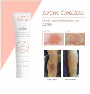 No. 7 - Avène Cicalfate Re'paratrice Cream - 2