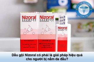 No. 2 - Dầu Gội Trị Gàu Và Nấm Da Đầu Nizoral - 4