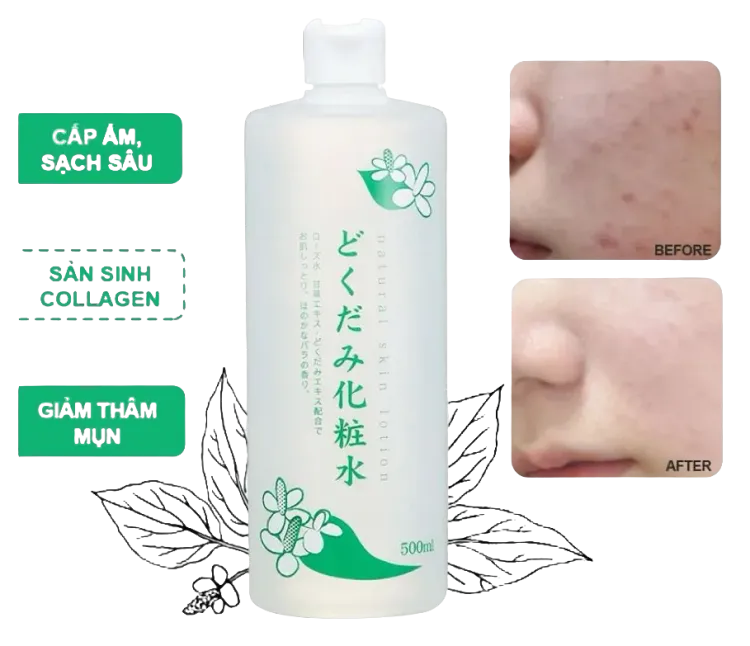 No. 8 - Nước Hoa Hồng Diếp Cá Dokudami Natural Skin Lotion - 3