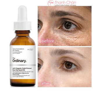 No. 1 - The Ordinary Serum Caffeine Solution 5% + EGCG - 3