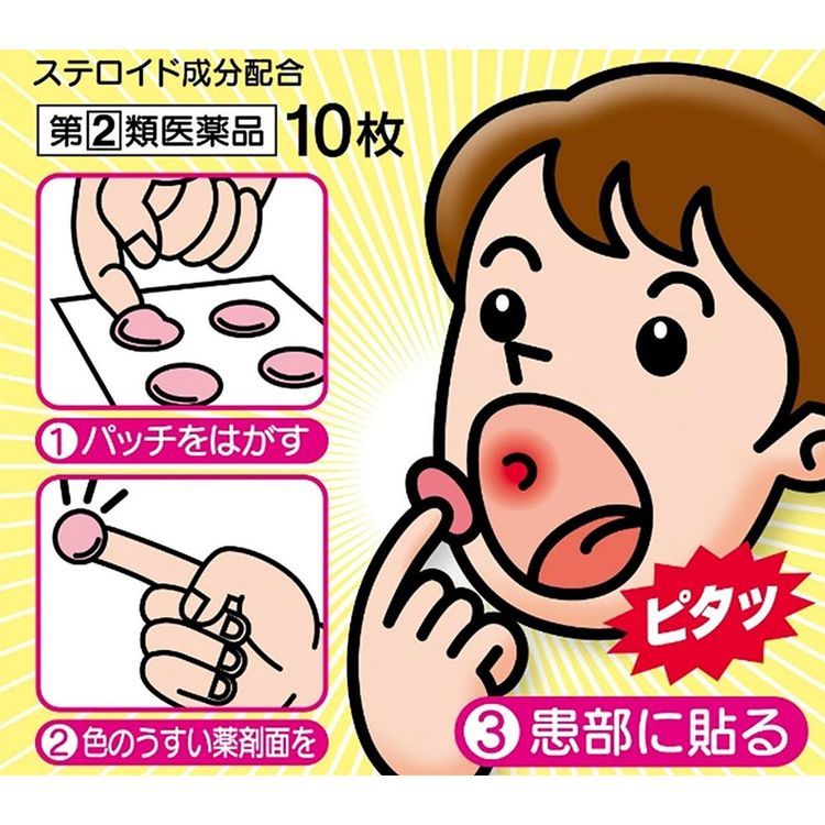 No. 3 - Miếng Dán Nhiệt Miệng Kounaien Canker Sore Patch Quick Care - 2