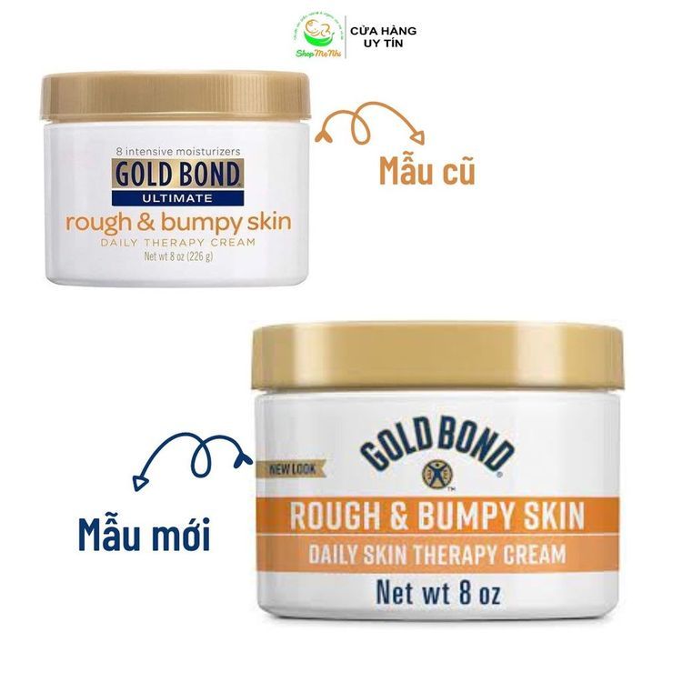 No. 5 - Kem Dưỡng Rough & Bumpy Skin Daily Therapy Cream1 - 3