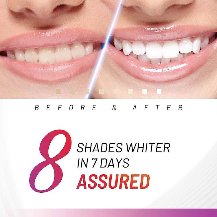 No. 4 - Accelarator Teeth Whitening Kit - 4