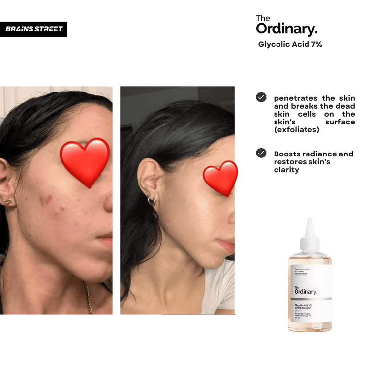 No. 4 - The Ordinary Glycolic Acid 7% Toning Solution - 6