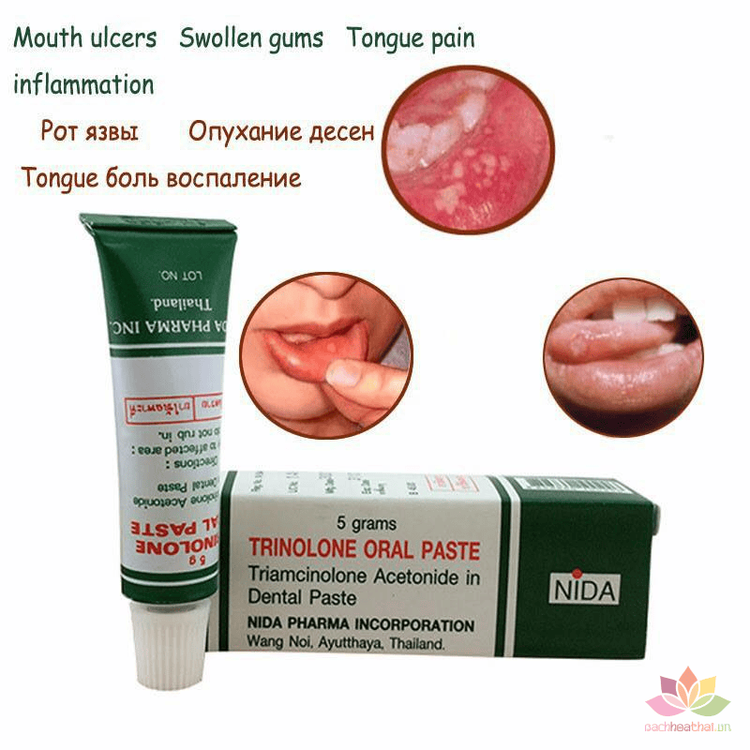 No. 8 - Thuốc Bôi Nhiệt Miệng Trinolone Oral Paste - 3