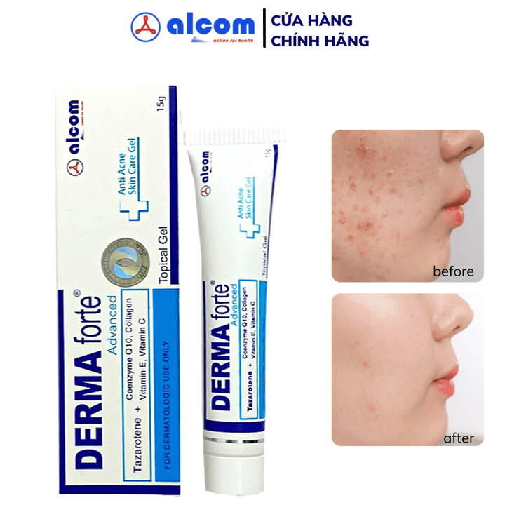 No. 1 - Gel Giảm Mụn, Mờ Thâm Derma Forte - 3