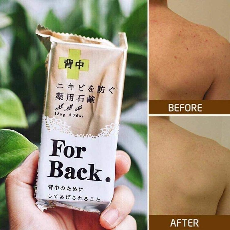 No. 4 - Xà Phòng Trị Mụn Lưng For Back Medicated Soap - 2